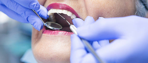 Best Emergency Tooth Extraction in Fort Rucker, AL